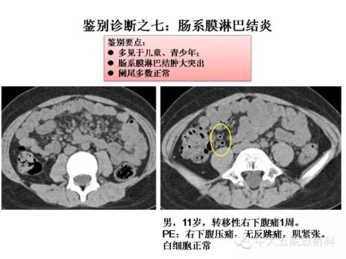 潘德的预言 版本同苹果官方下载a,前沿说明解析|CT_v4.723